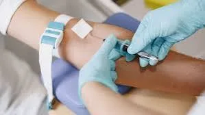 XÉT NGHIỆM SINH THIẾT LỎNG SPOT-MAS: HỖ TRỢ TẦM SOÁT UNG THƯ SỚM TỪ MẪU MÁU