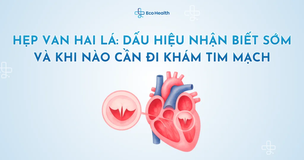 Hẹp van hai lá: Dấu hiệu nhận biết sớm và khi nào cần đi khám tim mạch