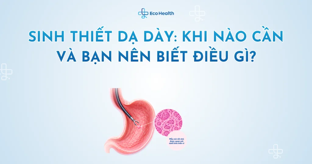 Sinh thiết dạ dày: khi nào cần và bạn nên biết điều gì?