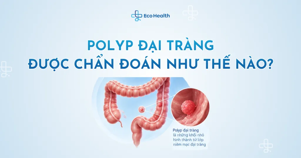 Polyp đại tràng được chẩn đoán như thế nào?