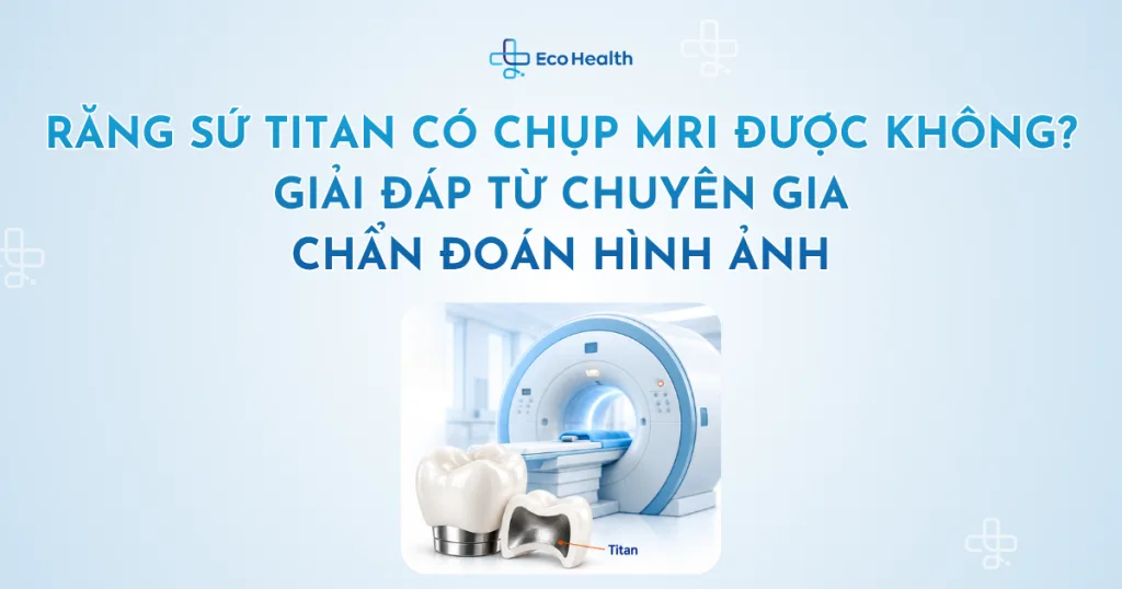 Răng sứ titan có chụp MRI được không? Giải đáp từ chuyên gia chẩn đoán hình ảnh