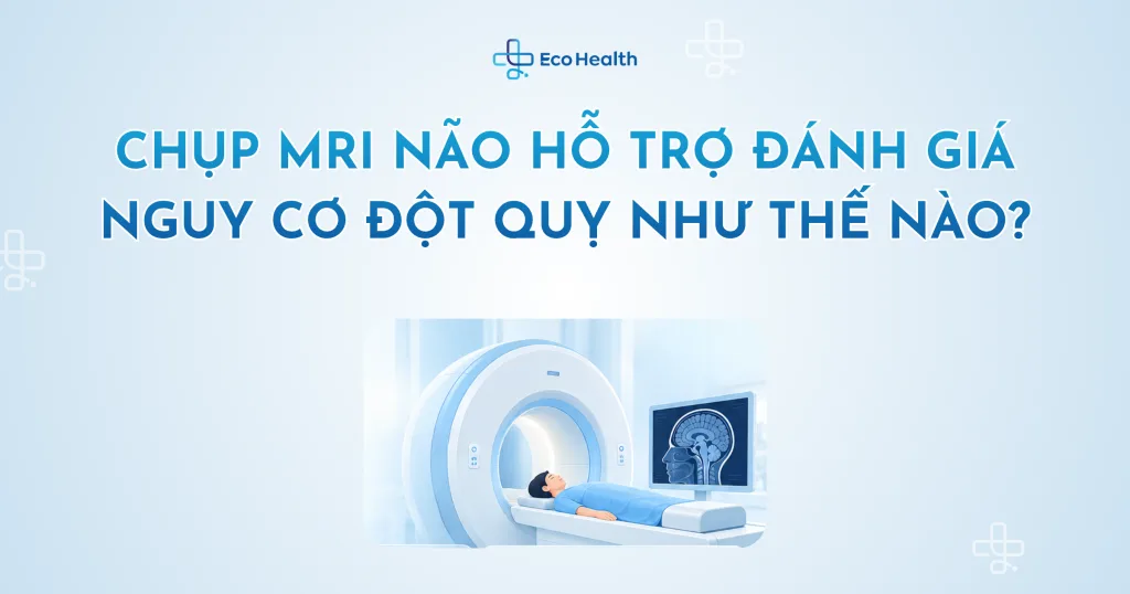 Chụp MRI não hỗ trợ đánh giá nguy cơ đột quỵ như thế nào?