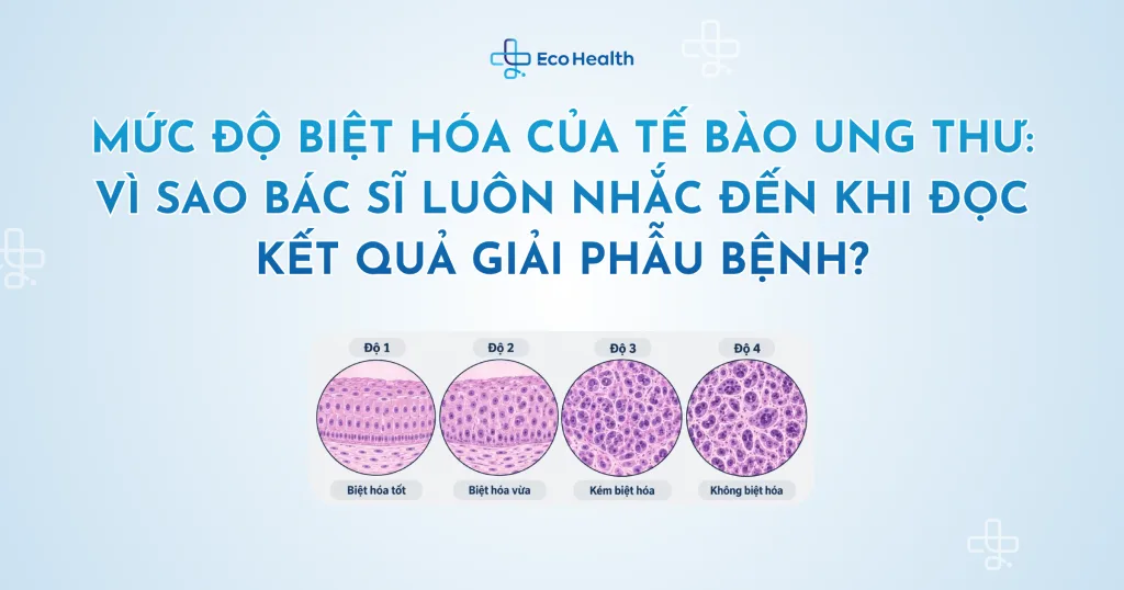 Mức độ biệt hóa của tế bào ung thư: Vì sao bác sĩ luôn nhắc đến khi đọc kết quả giải phẫu bệnh?