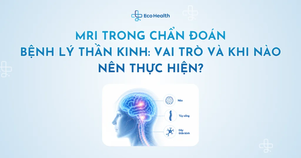 MRI trong chẩn đoán bệnh lý thần kinh: vai trò và khi nào nên thực hiện?